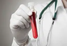 Combien coûte une prise de sang dans un laboratoire