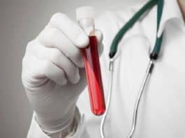 Combien coûte une prise de sang dans un laboratoire ? Combien coûte une prise de sang dans un laboratoire