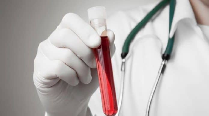 Combien coûte une prise de sang dans un laboratoire