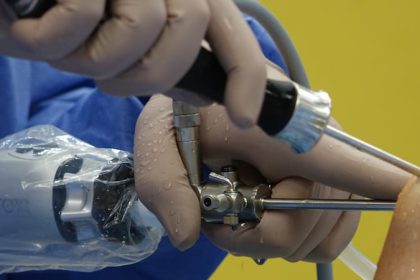 Une pose d'une prothèse du genou