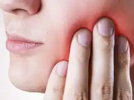 La prévention de l’infection de dent de sagesse