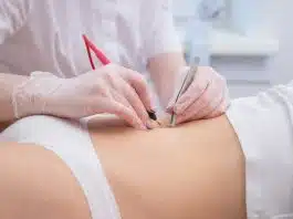 Épilation du maillot chez l’homme : quels en sont les avantages, et quels outils pouvez-vous utiliser ?